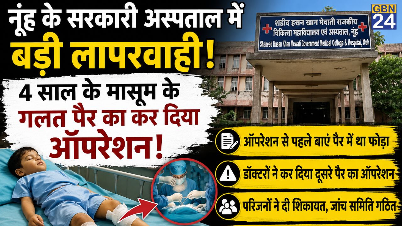 नूंह के अस्पताल में 4 साल के मासूम के गलत पैर किया ऑपरेशन